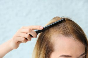 queda de cabelo pós-parto 2